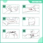 Kit de suture RHINO RESCUE™ Kit de suture RHINO RESCUE™